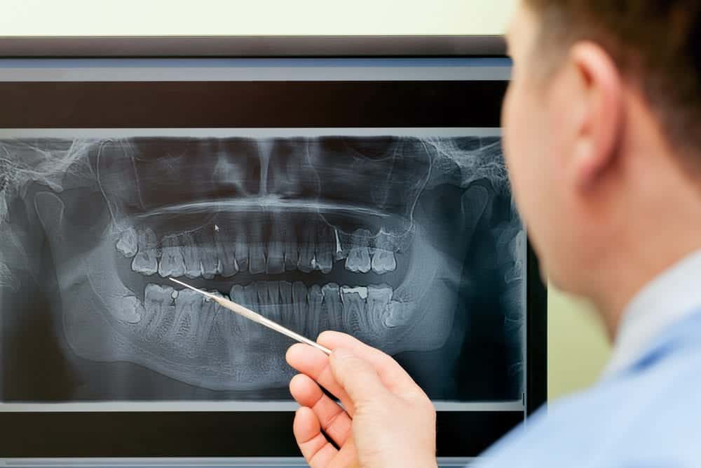 Dental Xrays, Laraway Family Dentistry, Family Dentist in the Woodlands, TX