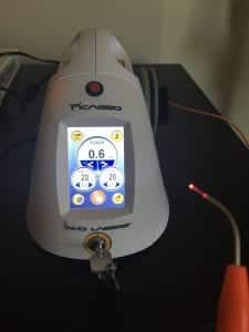 Picasso Laser, Advanced Technology, Laraway Family Dentistry