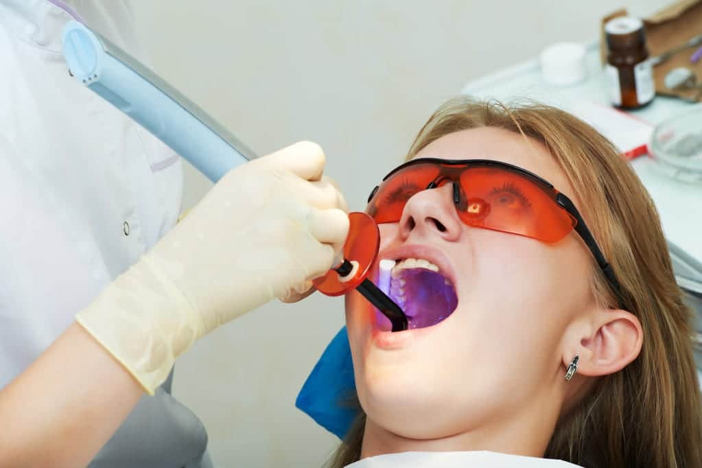 Dental Sealants, Laraway Family Dentistry, Family Dentist in the Woodlands, TX