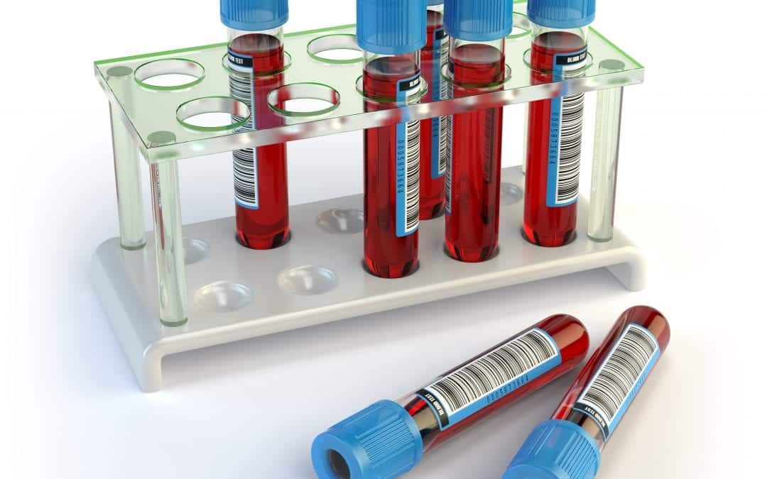 Serology-based tests for COVID-19